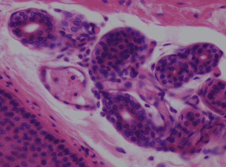 микроскоп phenix xsp 36